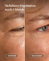 Eyes-Temple Pads with aloe vera