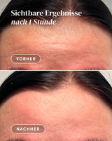 Forehead Pad with aloe vera