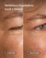 Eyes-Temple Pads with Ectoin