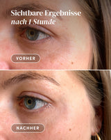 <tc>Eyes-Temple Pads with hexapeptide</tc>