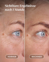Eyes-Temple Pads with hyaluronic acid