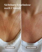 Décolleté Pad with hyaluronic acid