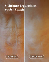 Neck Pad with hyaluronic acid