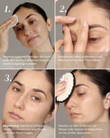 Frown lines patches with Hyaluron