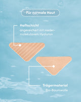 Frown lines patches with Hyaluron