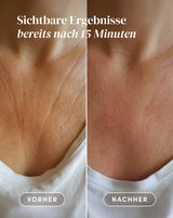 Décolleté Pad with vitamin C