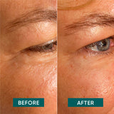 Eye Temple Pads Aloe Vera
