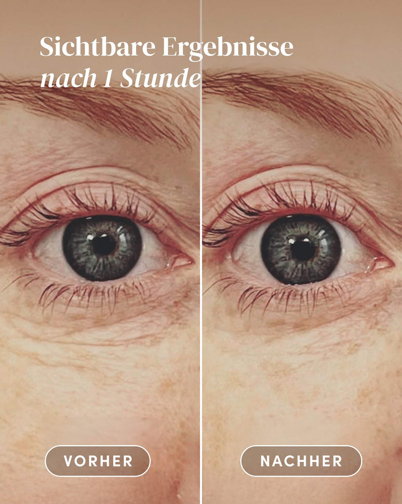 Glitter eyes Pads with hyaluronic acid