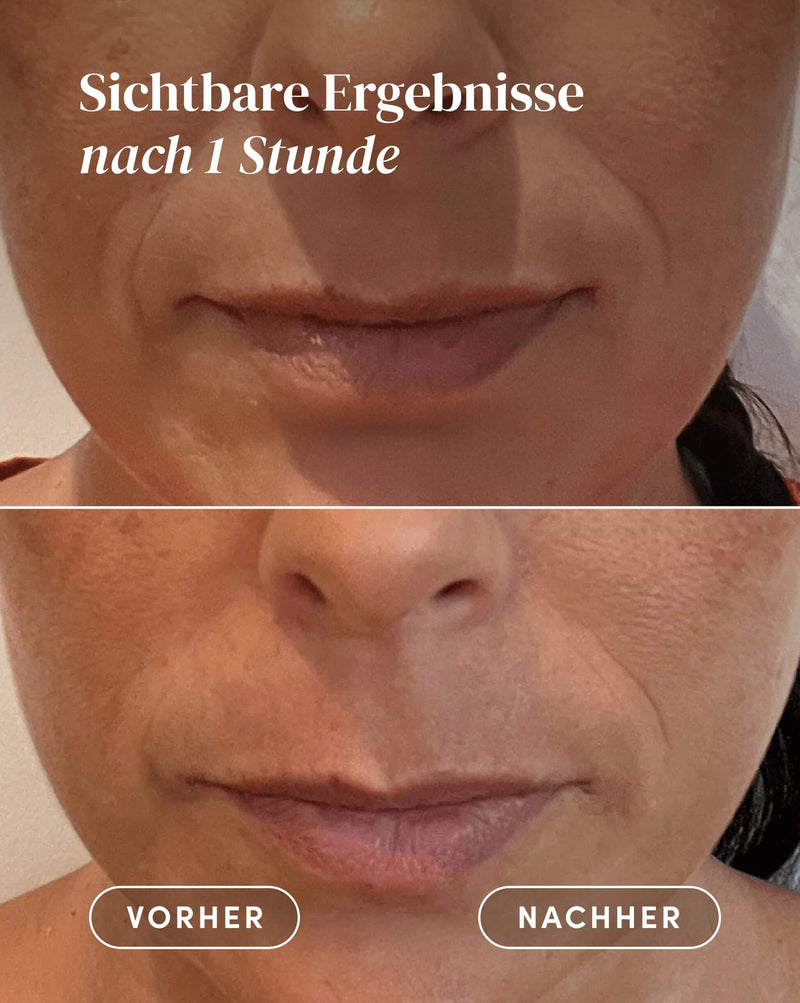 Mouth Pads with hyaluronic acid