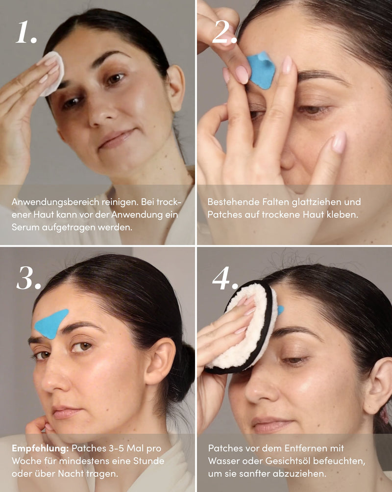 Frown lines patches with hyaluron - blue