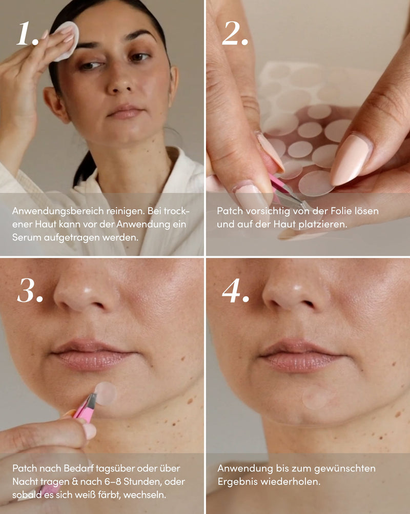 Pimples patches