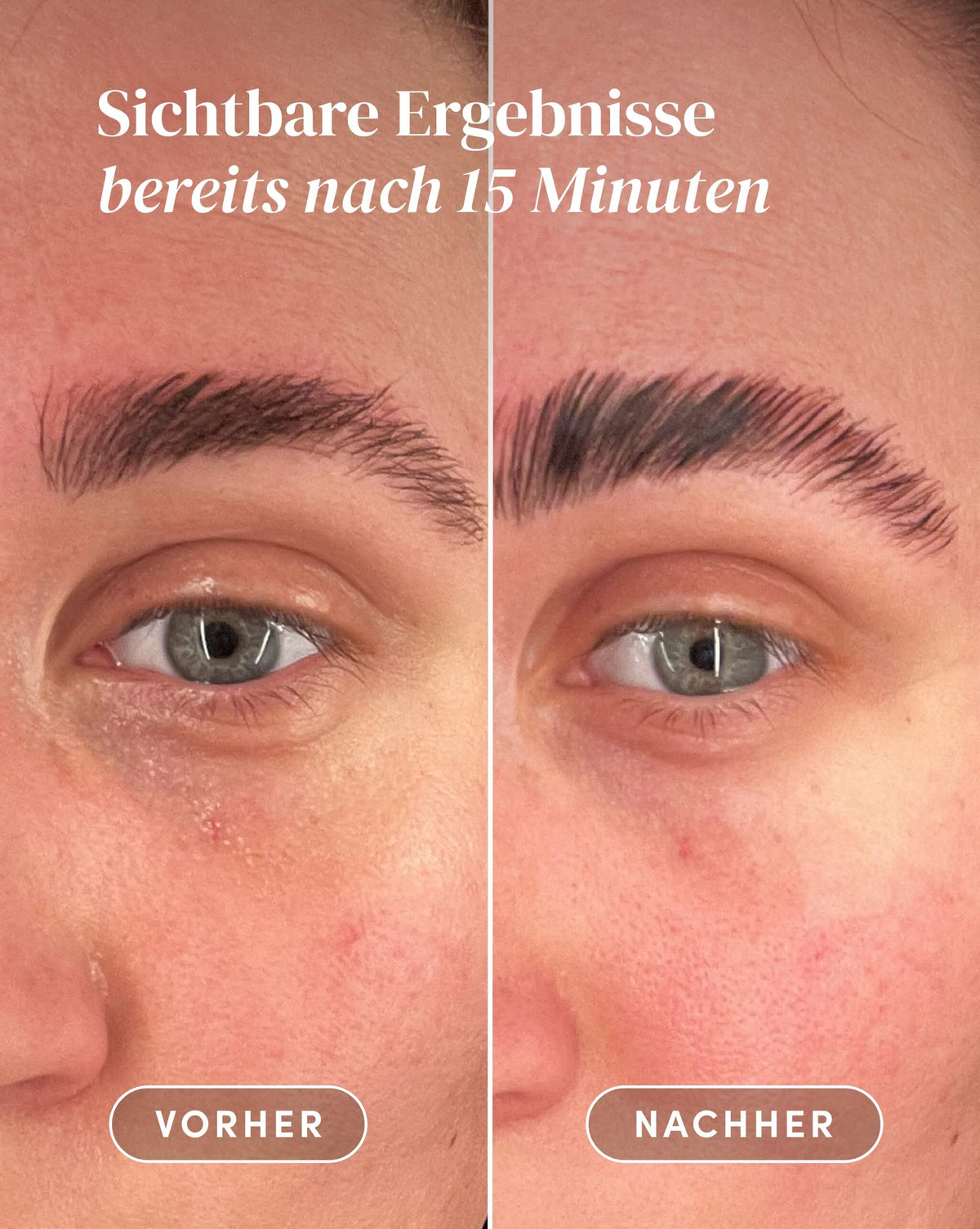 Vorher-Nachher-Ergebnis nach Anwendung der Vitamin C Augenpads