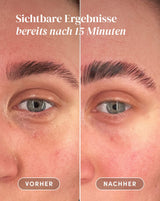 Eye Pads with Vitamin C