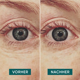 Eyes of pads with hyaluron