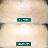 Forehead <tc>Pad</tc> with aloe vera